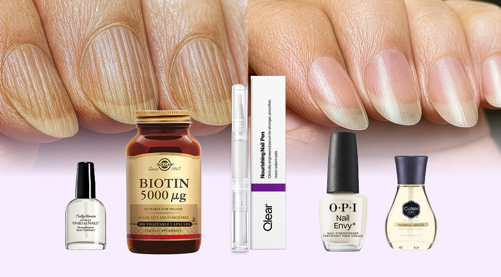 Tired of nail ridges that make your hands appear older? This dermatologist reviewed 5 popular solutions (only one worked for women over 50)